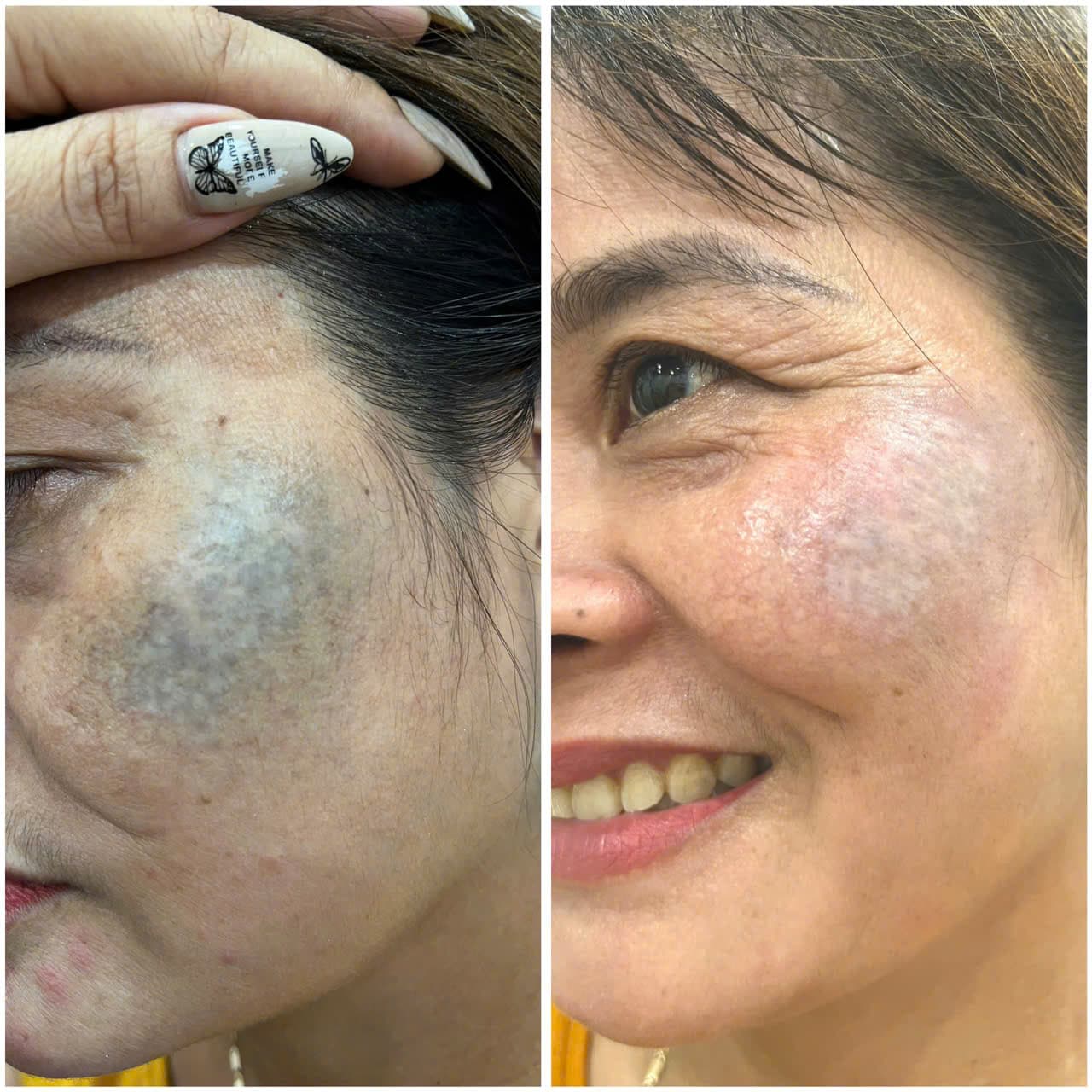 Hình ảnh kết quả 070