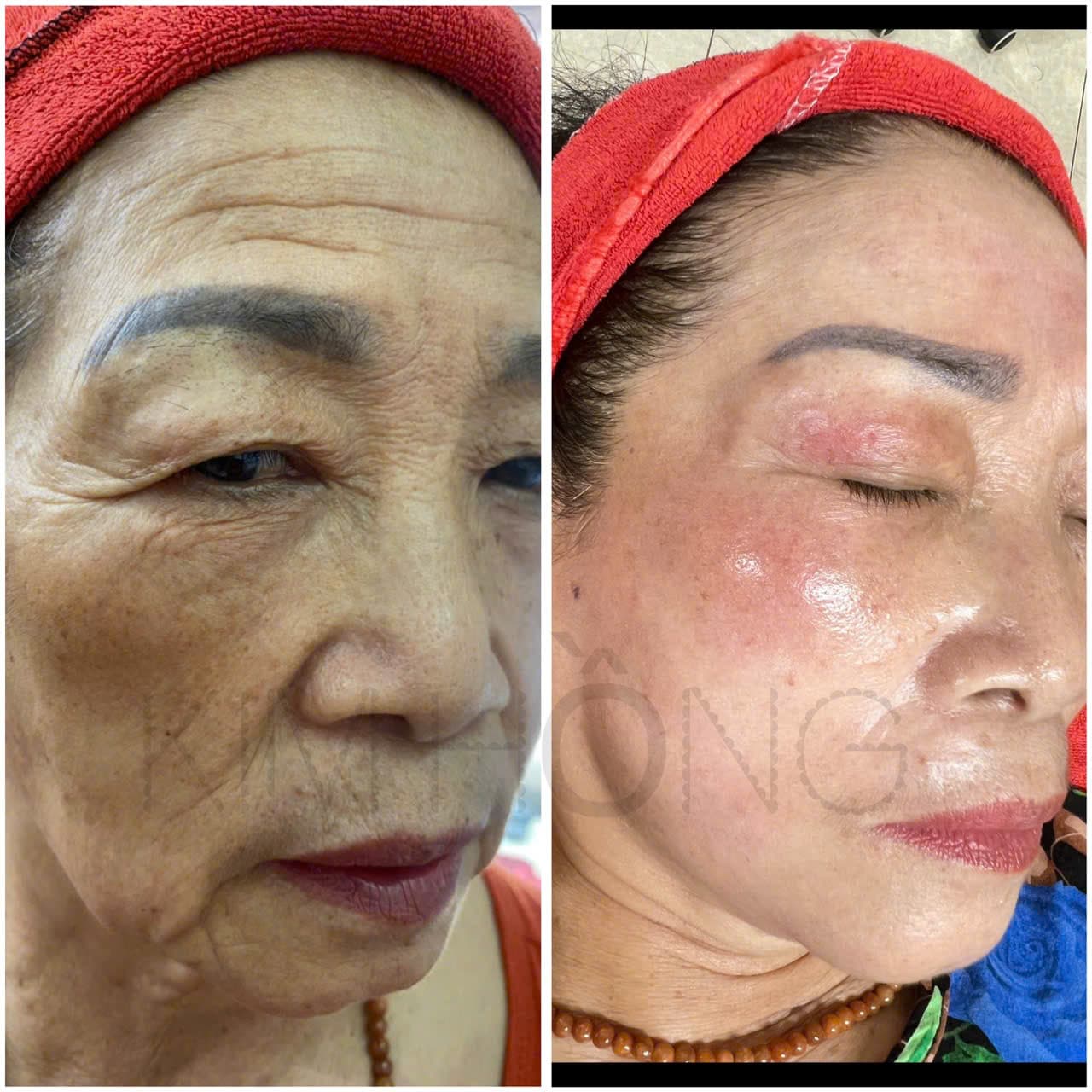 Hình ảnh kết quả 071