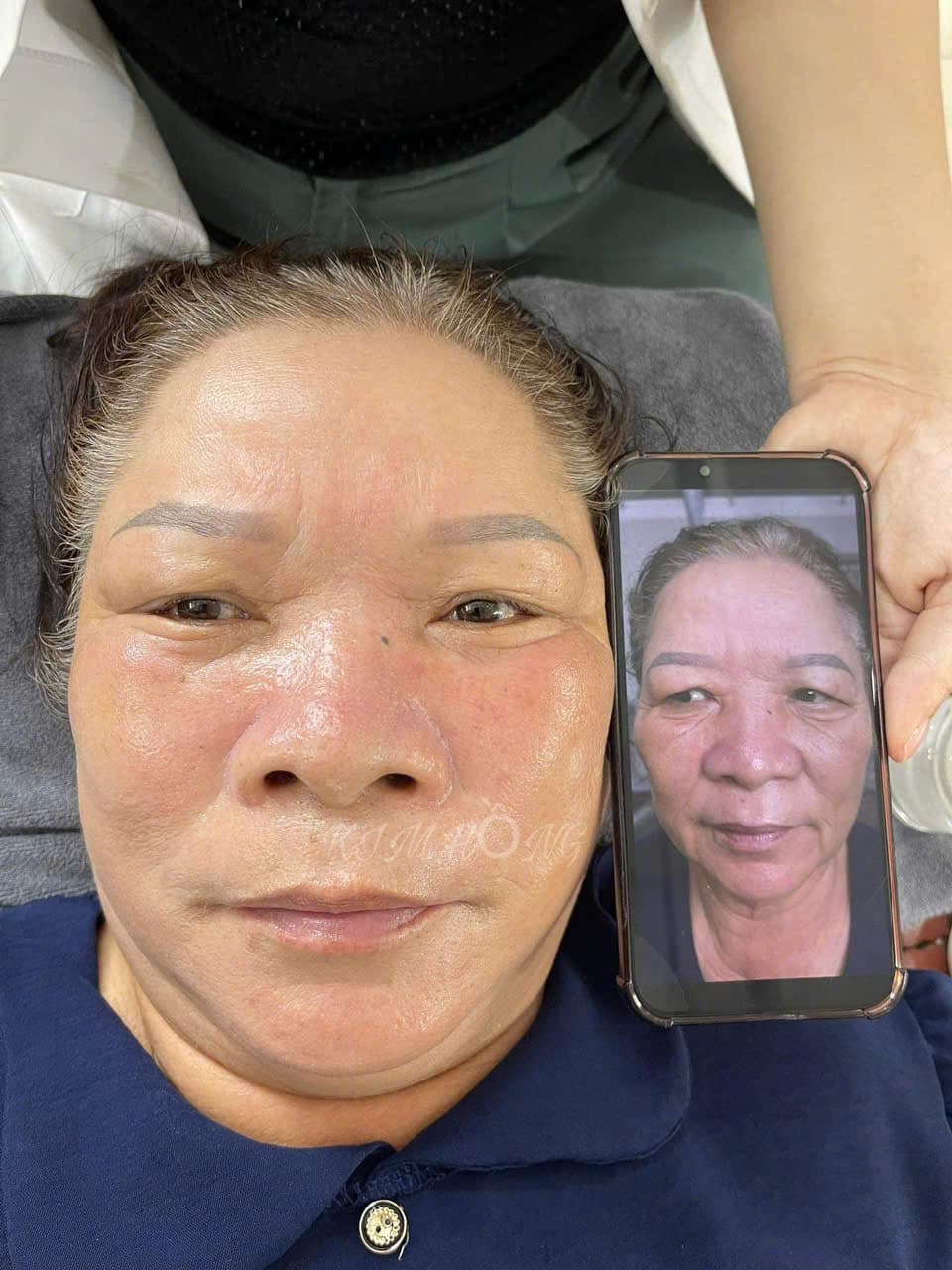 Hình ảnh kết quả 072