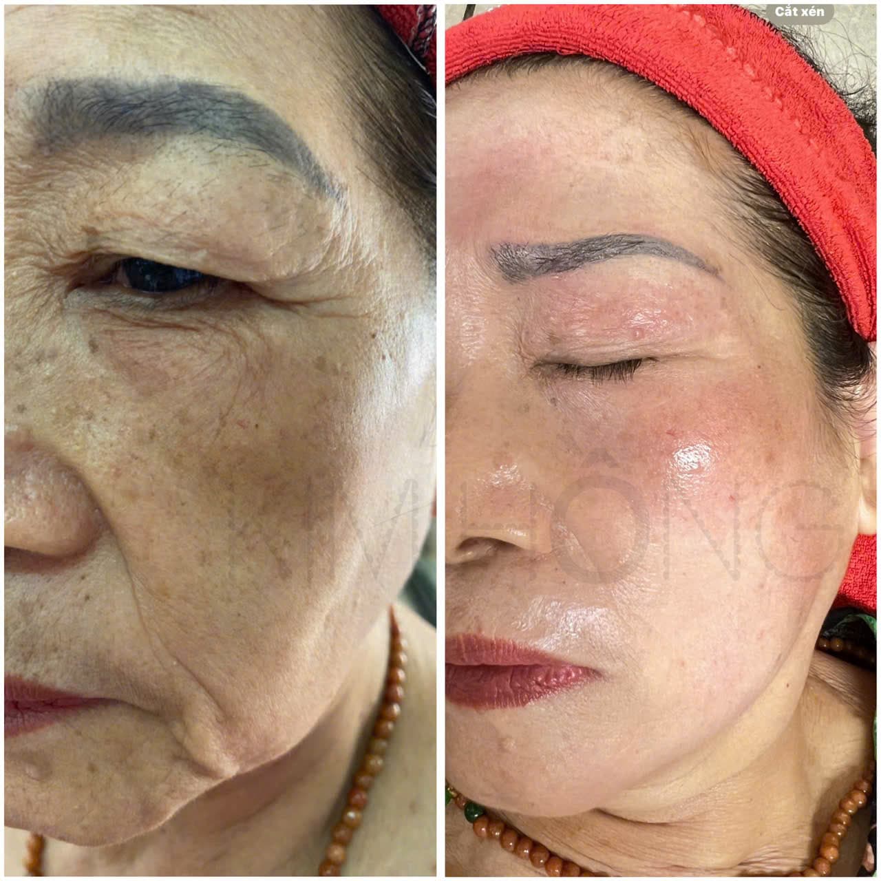 Hình ảnh kết quả 074