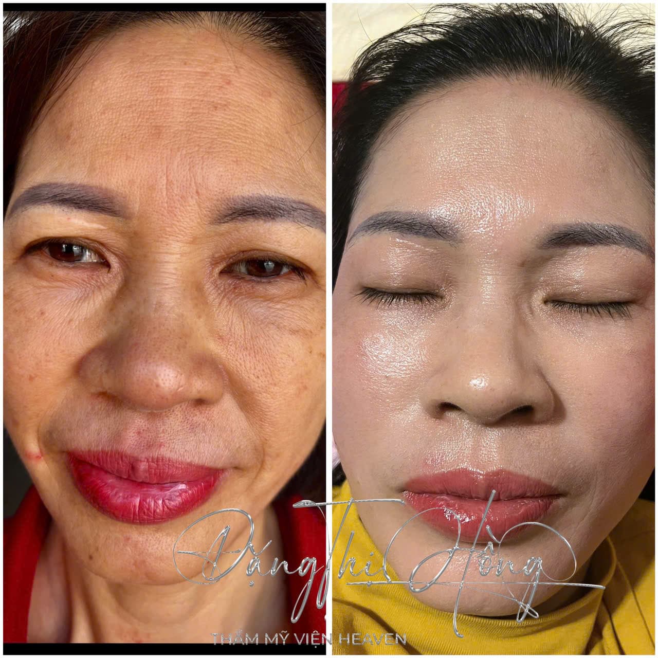 Hình ảnh kết quả 075