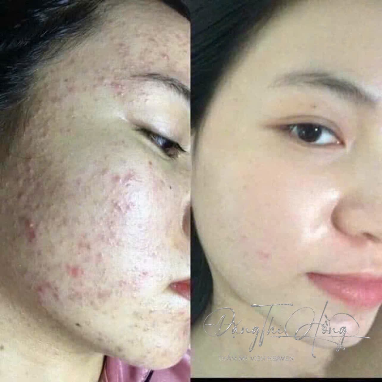 Hình ảnh kết quả 076