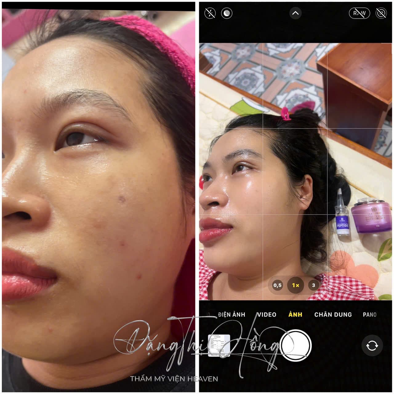 Hình ảnh kết quả 077