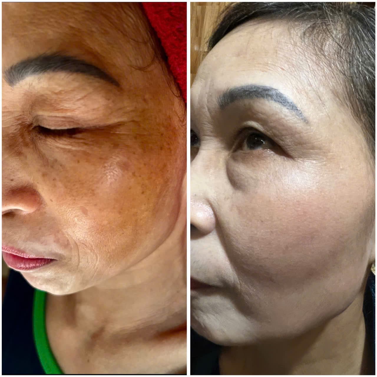Hình ảnh kết quả 078
