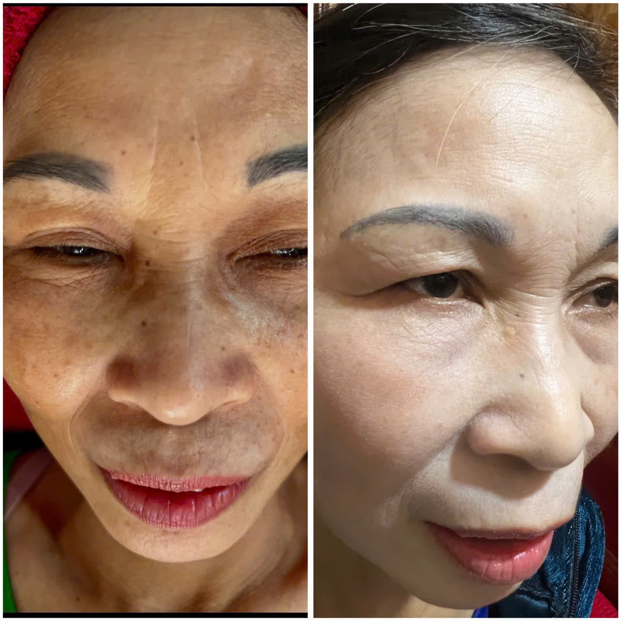 Hình ảnh kết quả 079