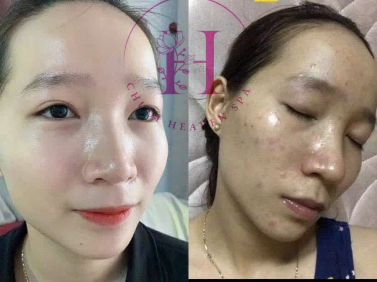 Hình ảnh kết quả 080