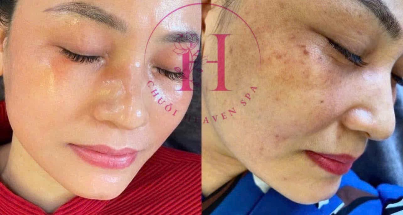Hình ảnh kết quả 081
