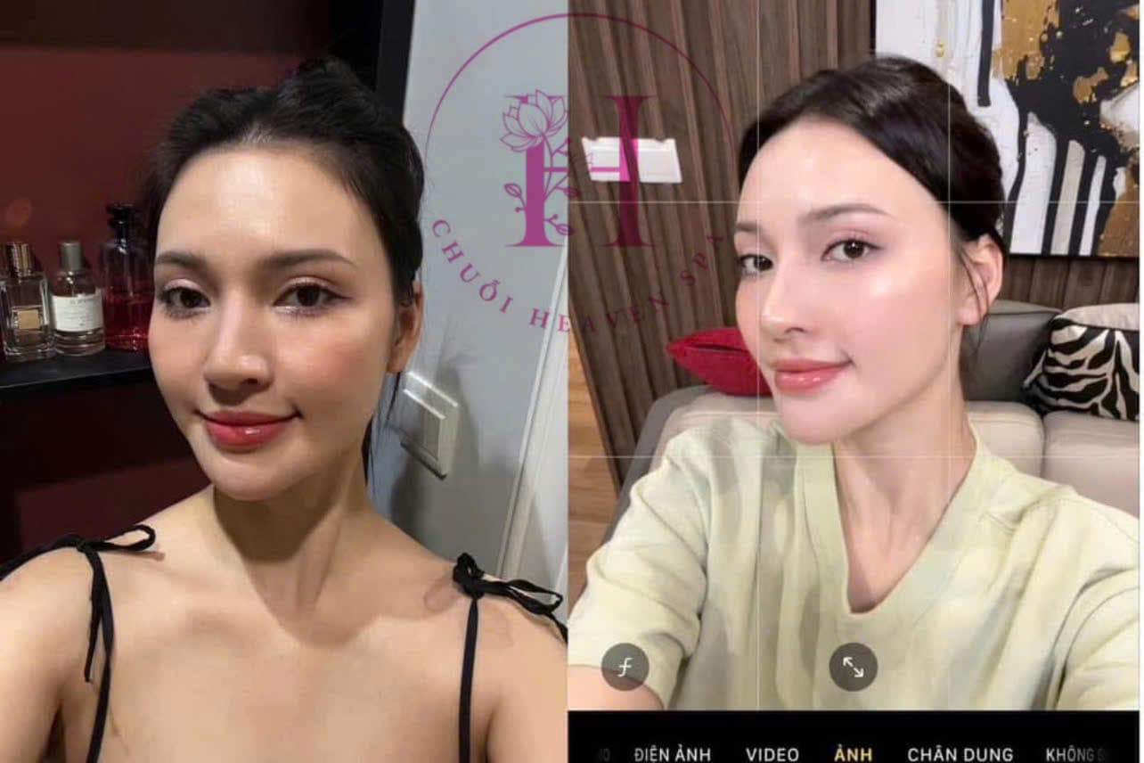 Hình ảnh kết quả 082