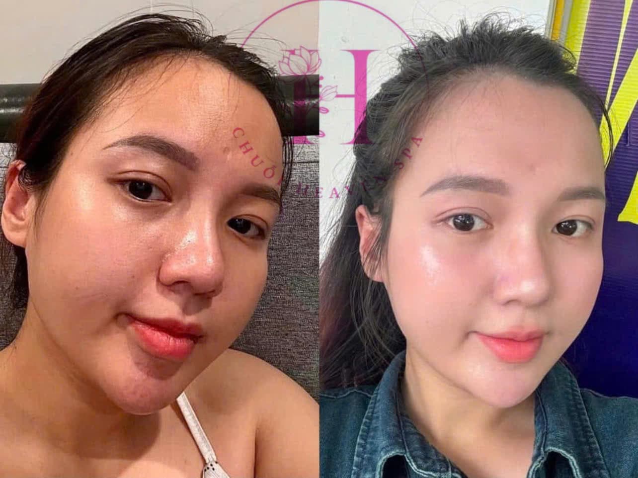 Hình ảnh kết quả 083