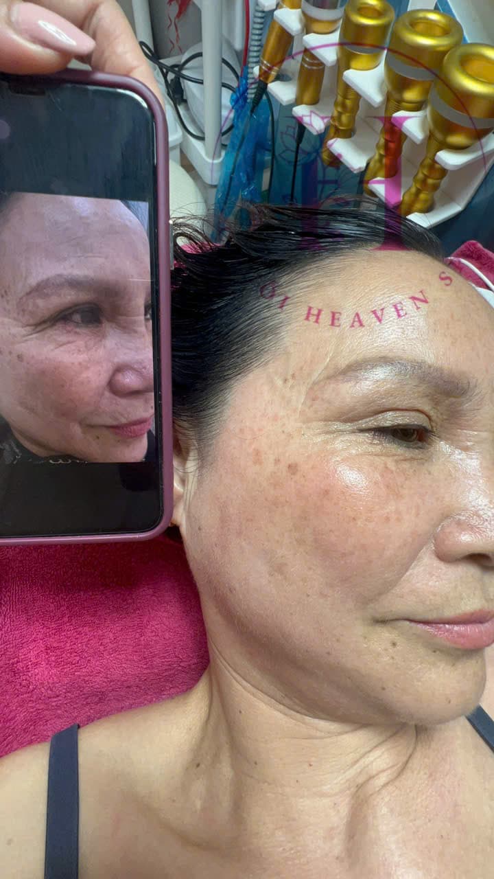 Hình ảnh kết quả 084