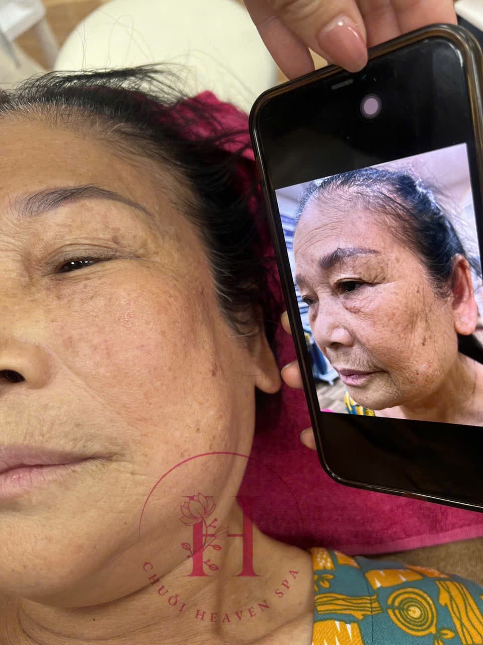 Hình ảnh kết quả 087