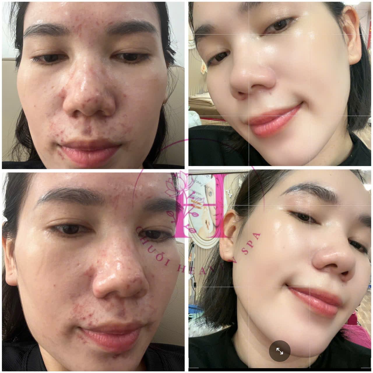 Hình ảnh kết quả 089