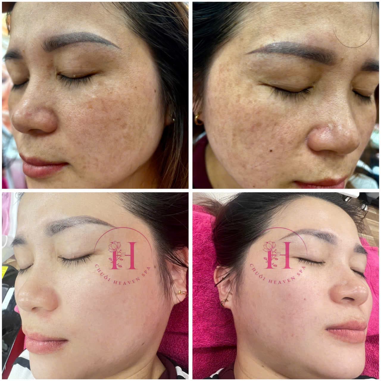 Hình ảnh kết quả 092