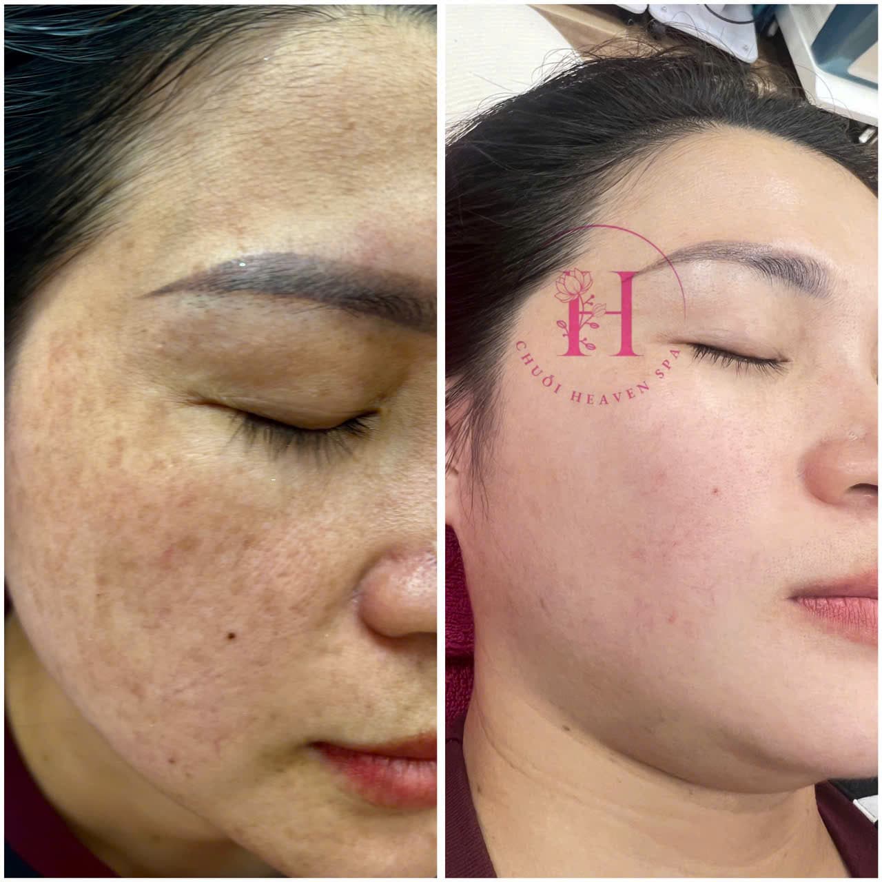 Hình ảnh kết quả 094