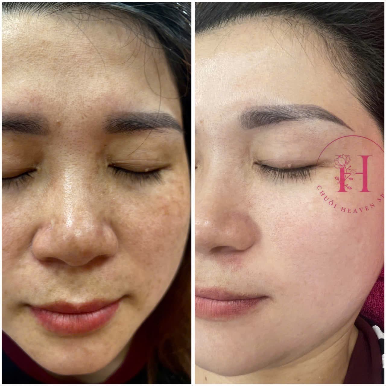 Hình ảnh kết quả 095