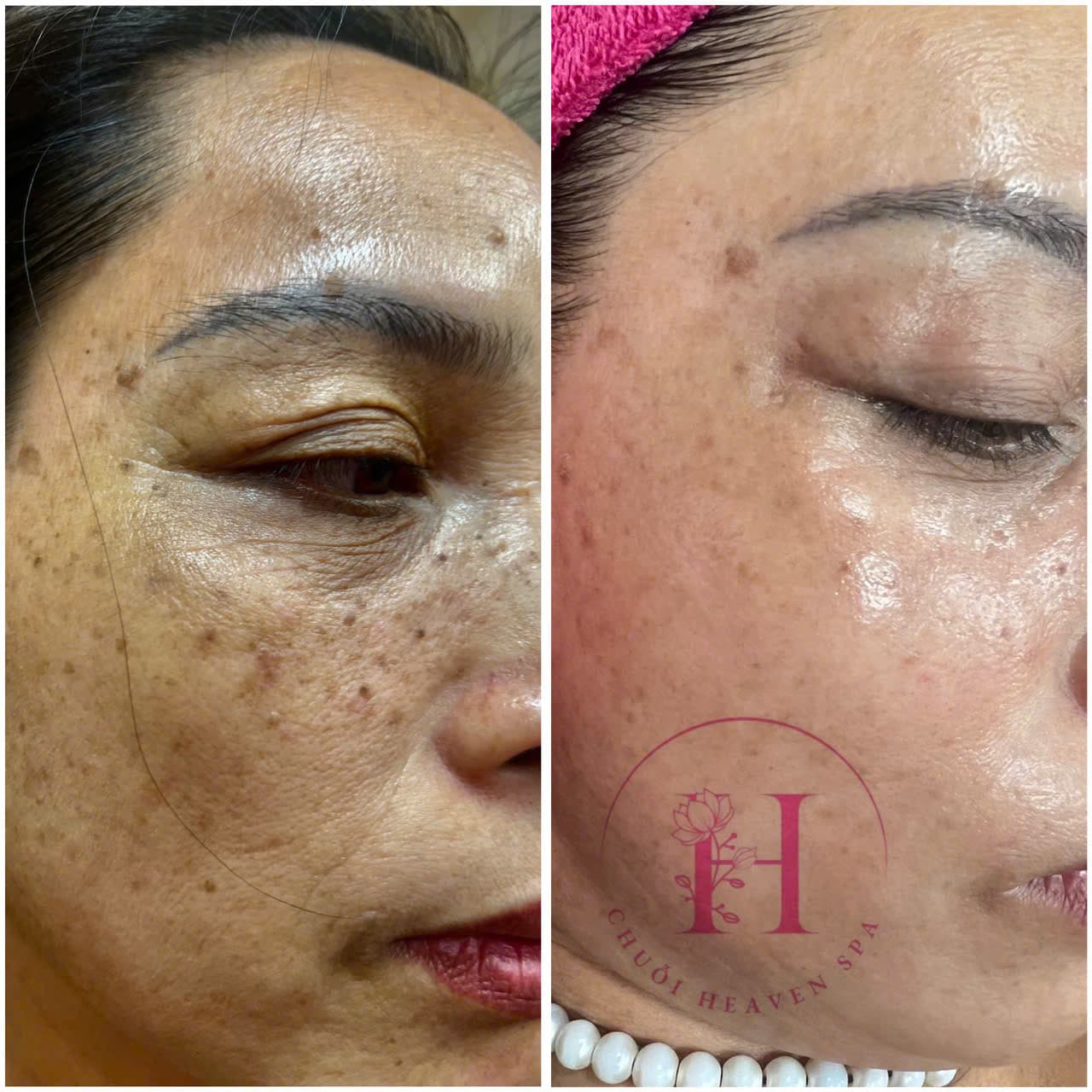 Hình ảnh kết quả 096