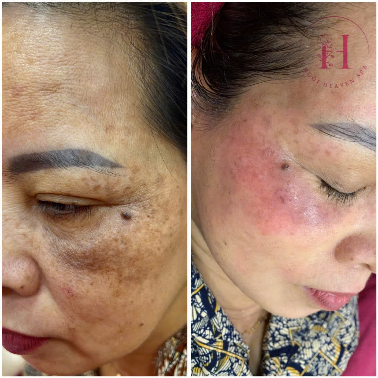 Hình ảnh kết quả 098