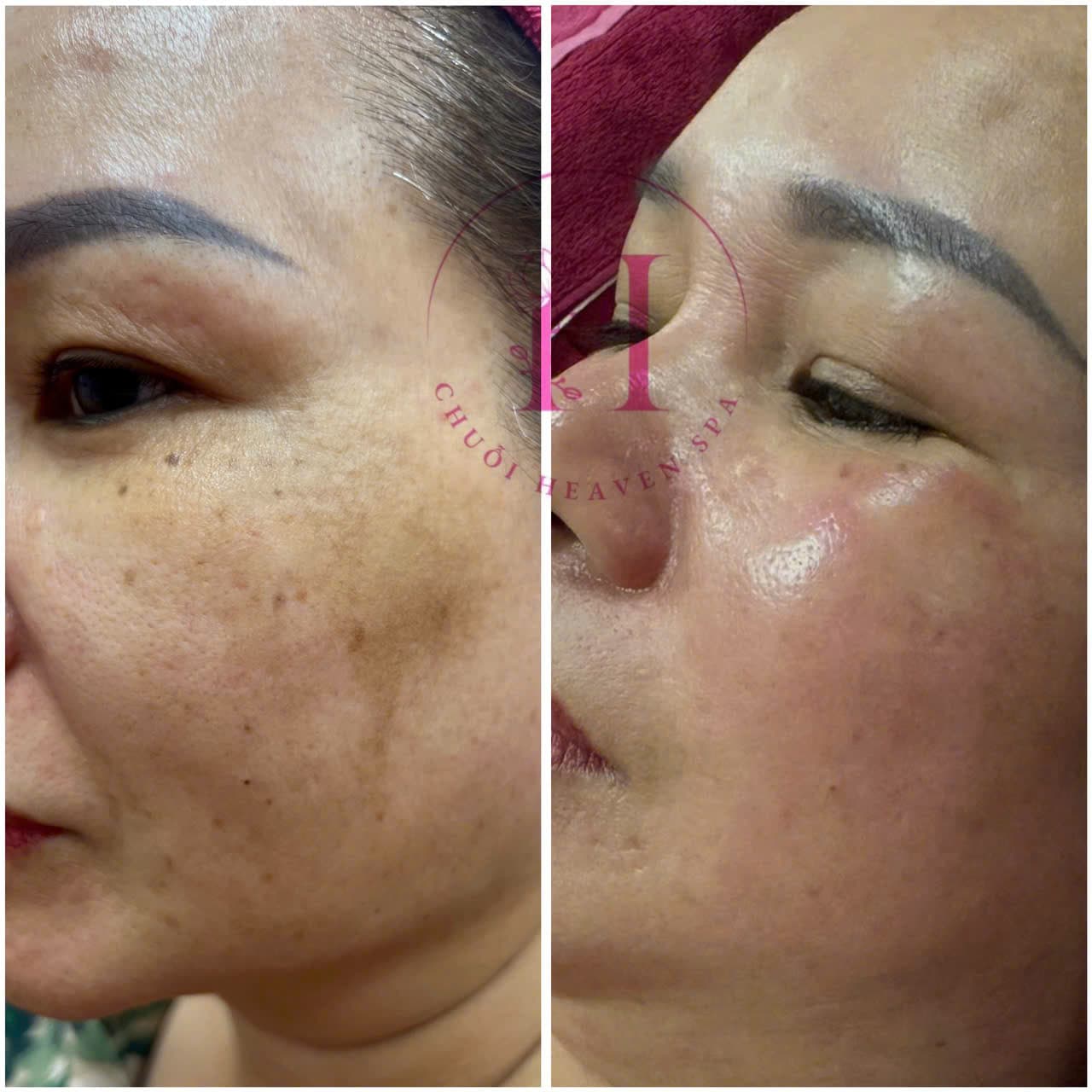Hình ảnh kết quả 099