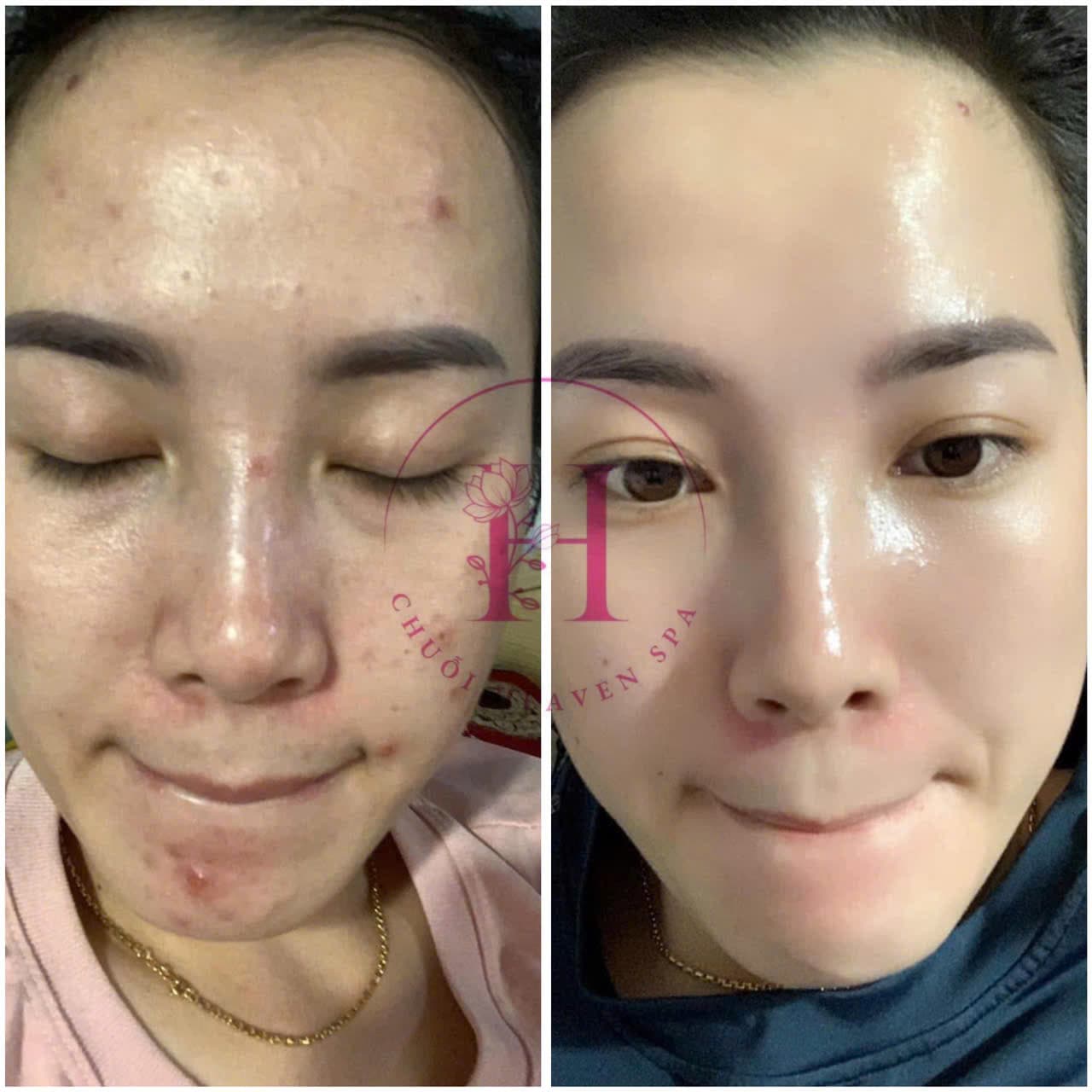 Hình ảnh kết quả 100