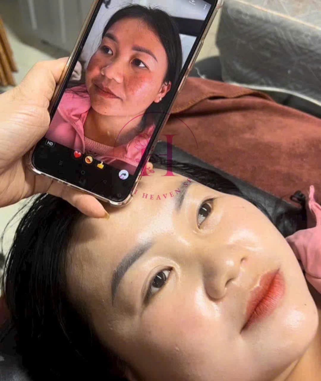 Hình ảnh kết quả 101