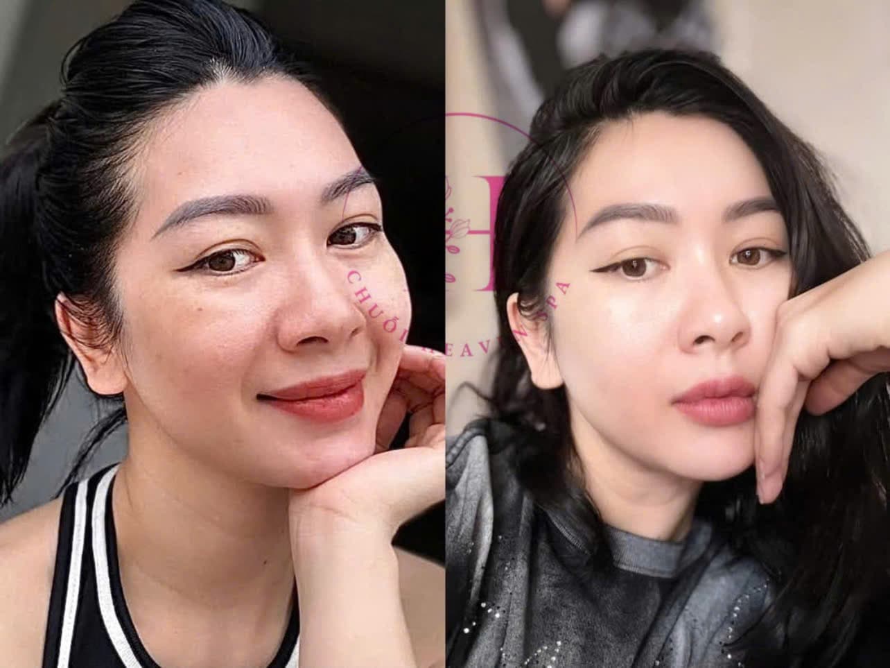 Hình ảnh kết quả 102