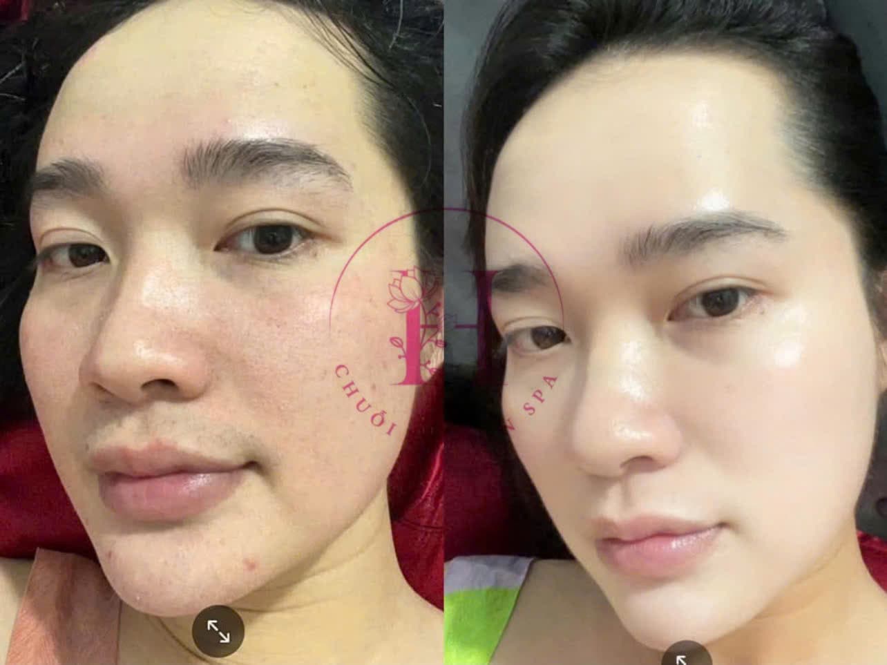Hình ảnh kết quả 103
