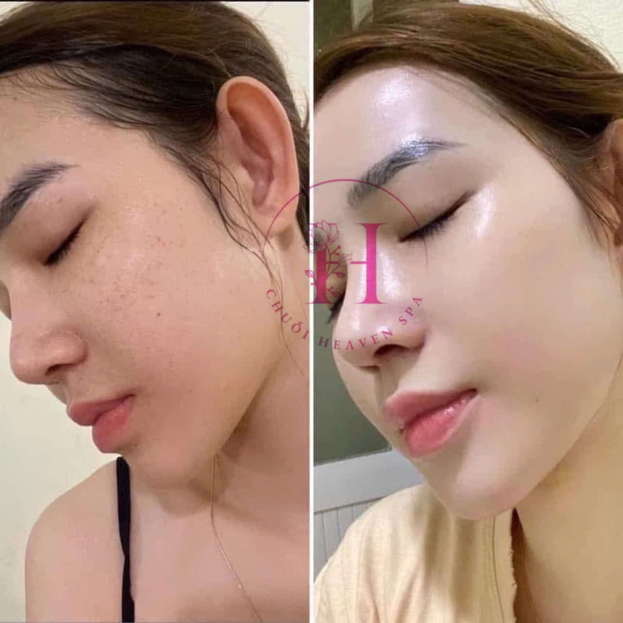 Hình ảnh kết quả 104