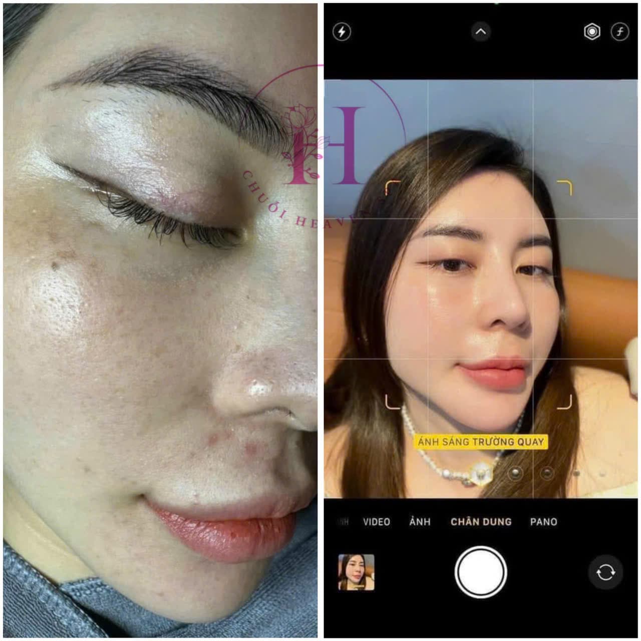 Hình ảnh kết quả 105
