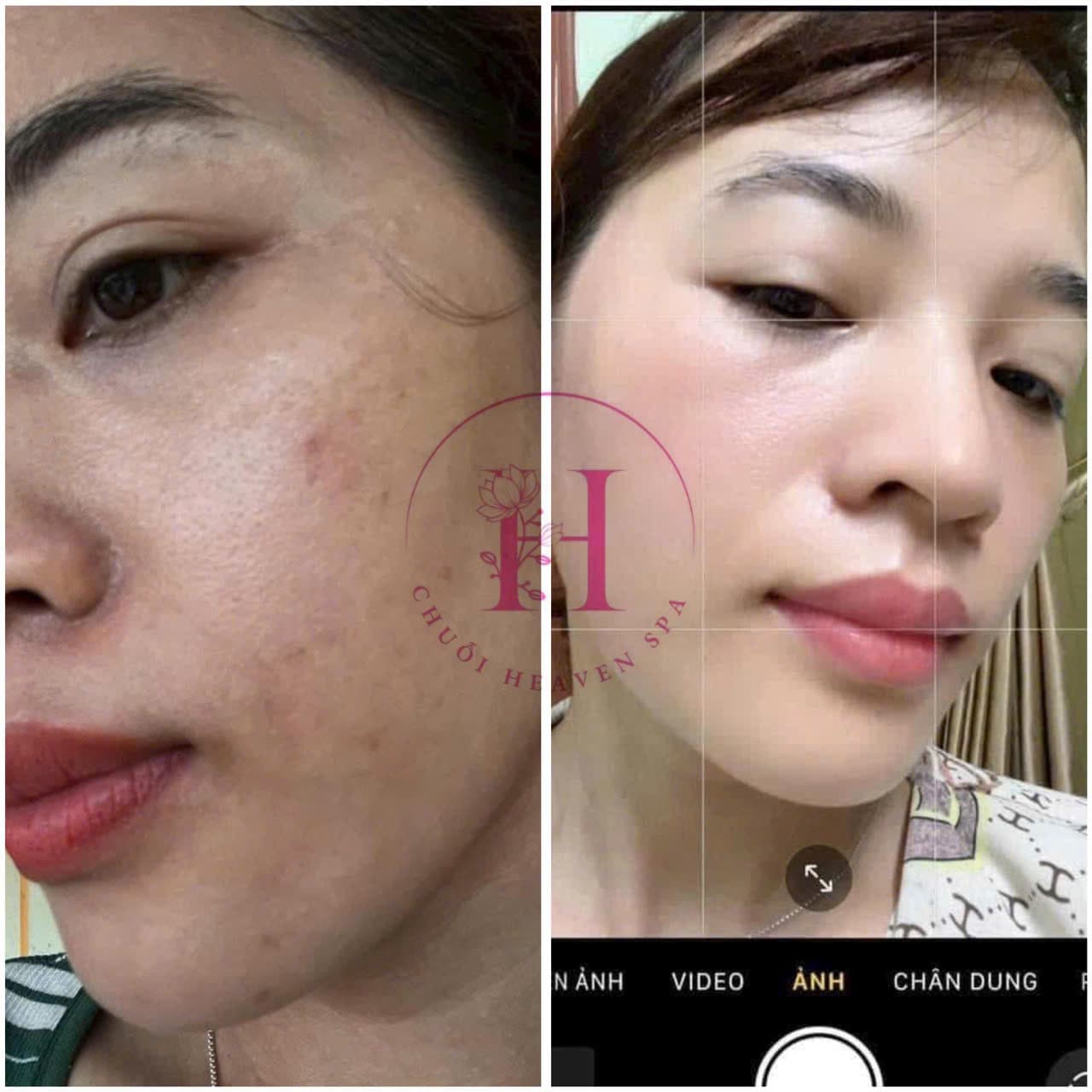 Hình ảnh kết quả 106