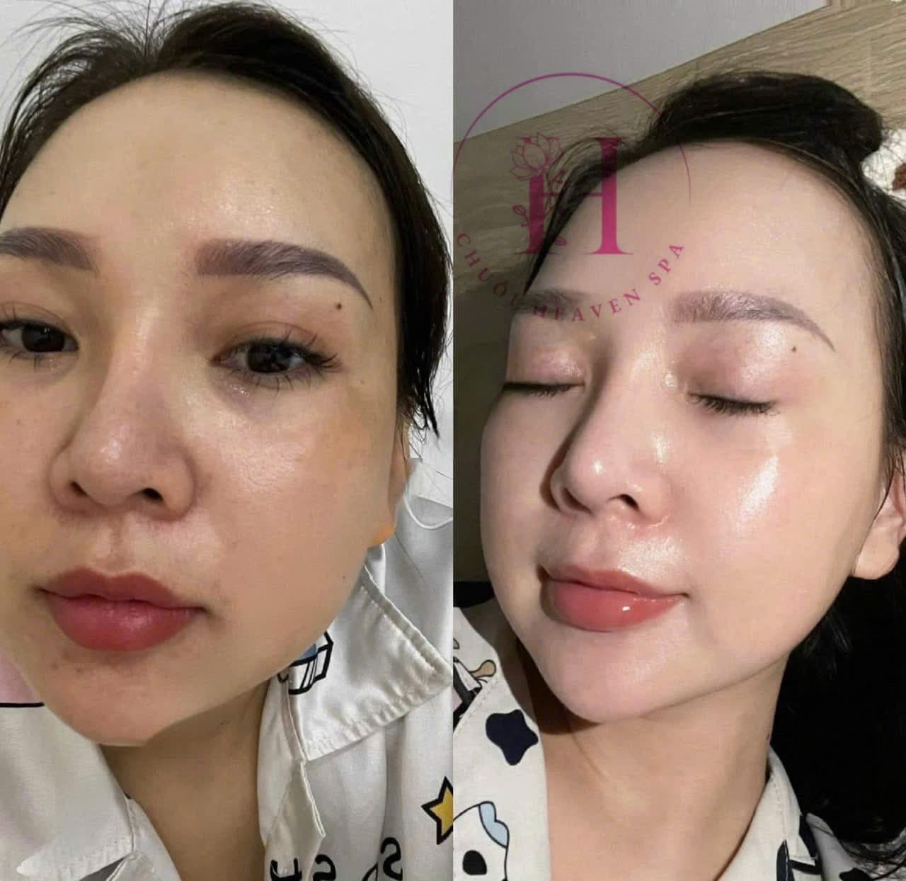 Hình ảnh kết quả 110