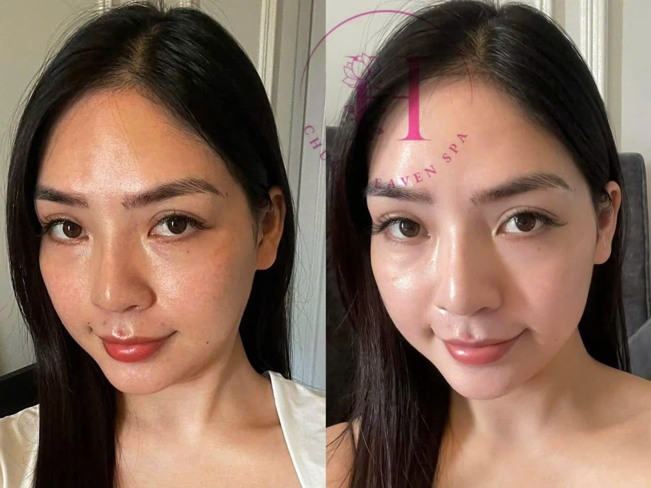 Hình ảnh kết quả 111