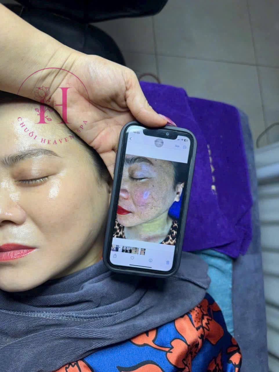 Hình ảnh kết quả 112