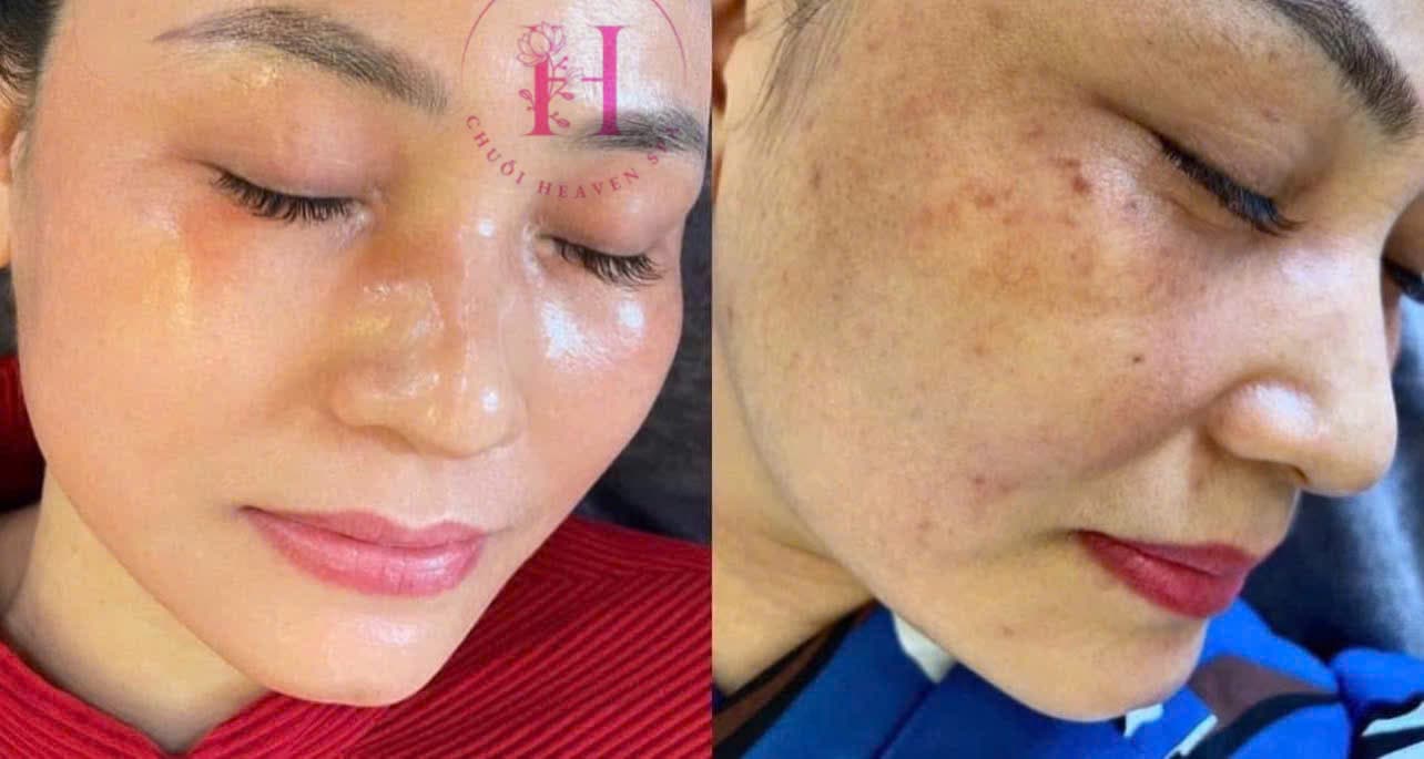 Hình ảnh kết quả 113