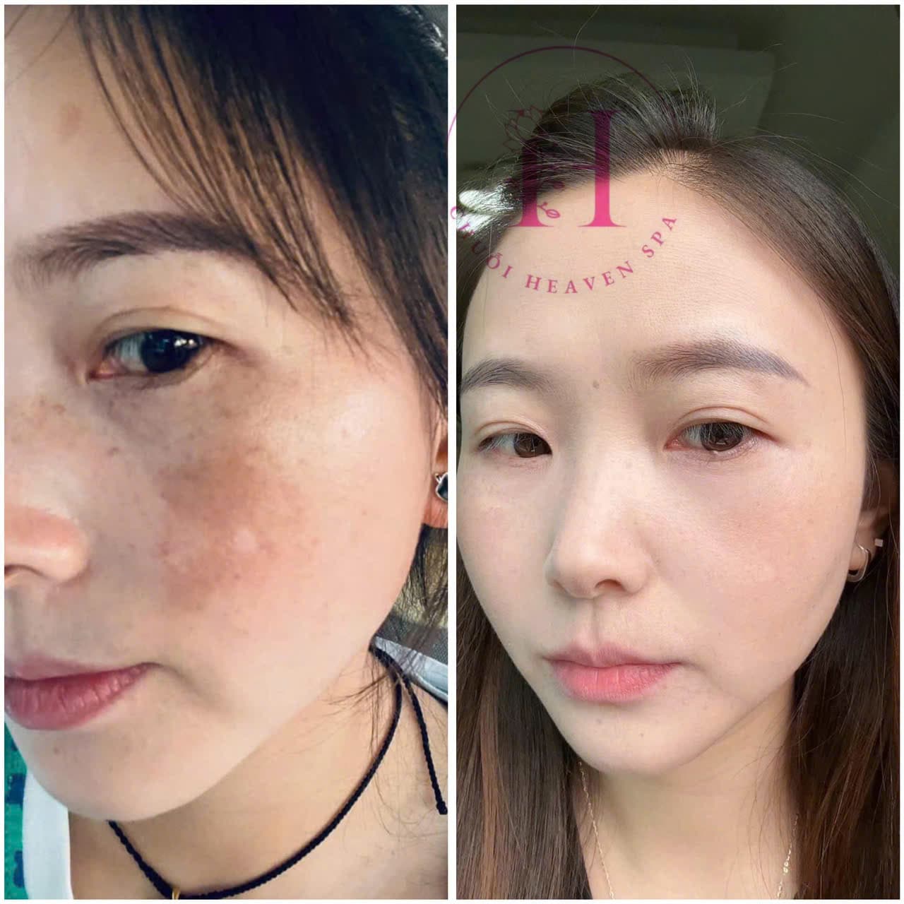 Hình ảnh kết quả 114