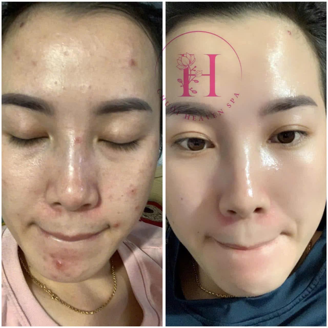 Hình ảnh kết quả 115
