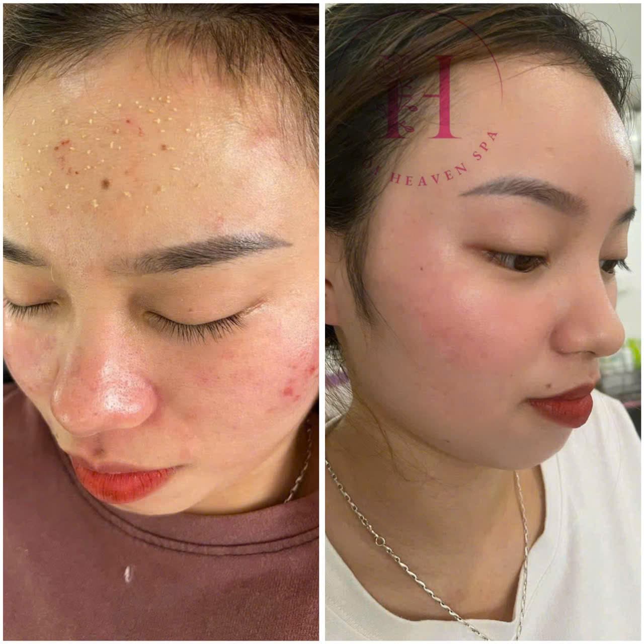 Hình ảnh kết quả 116