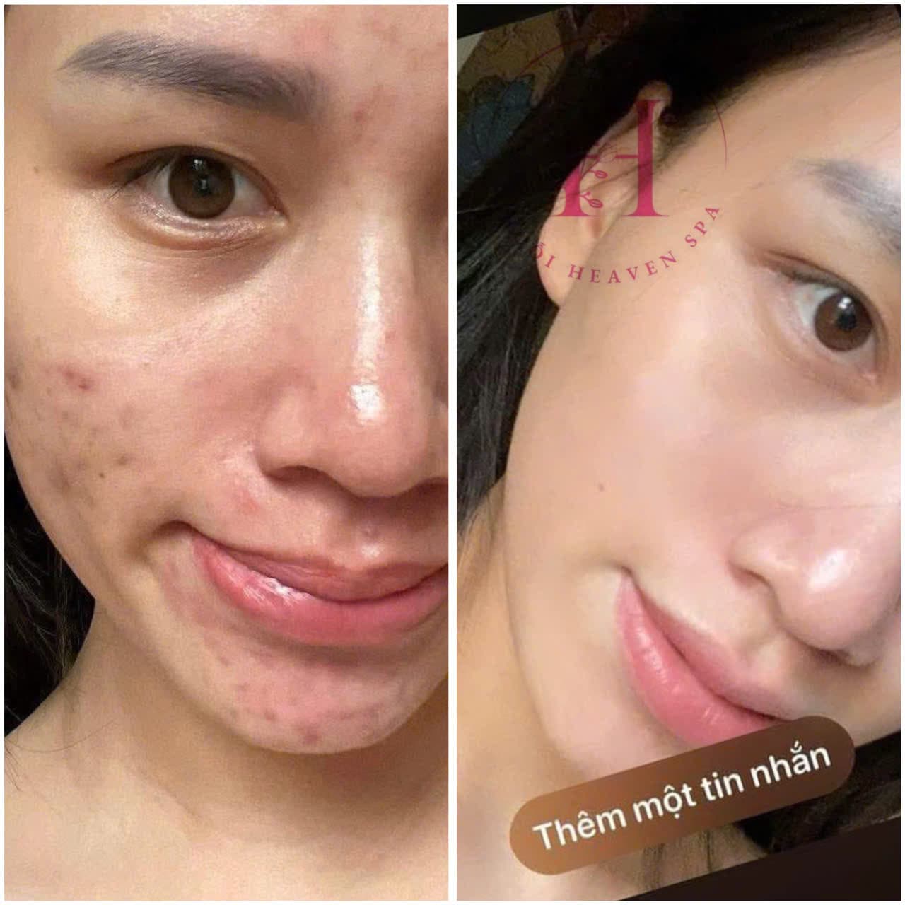 Hình ảnh kết quả 117