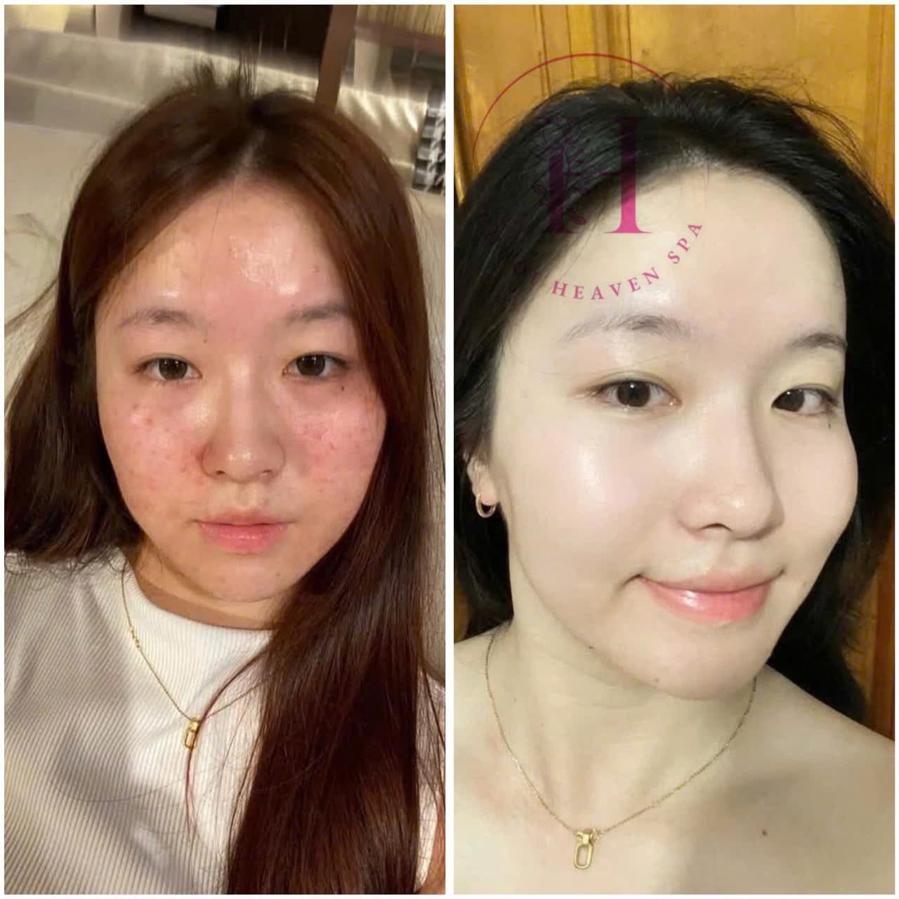 Hình ảnh kết quả 118