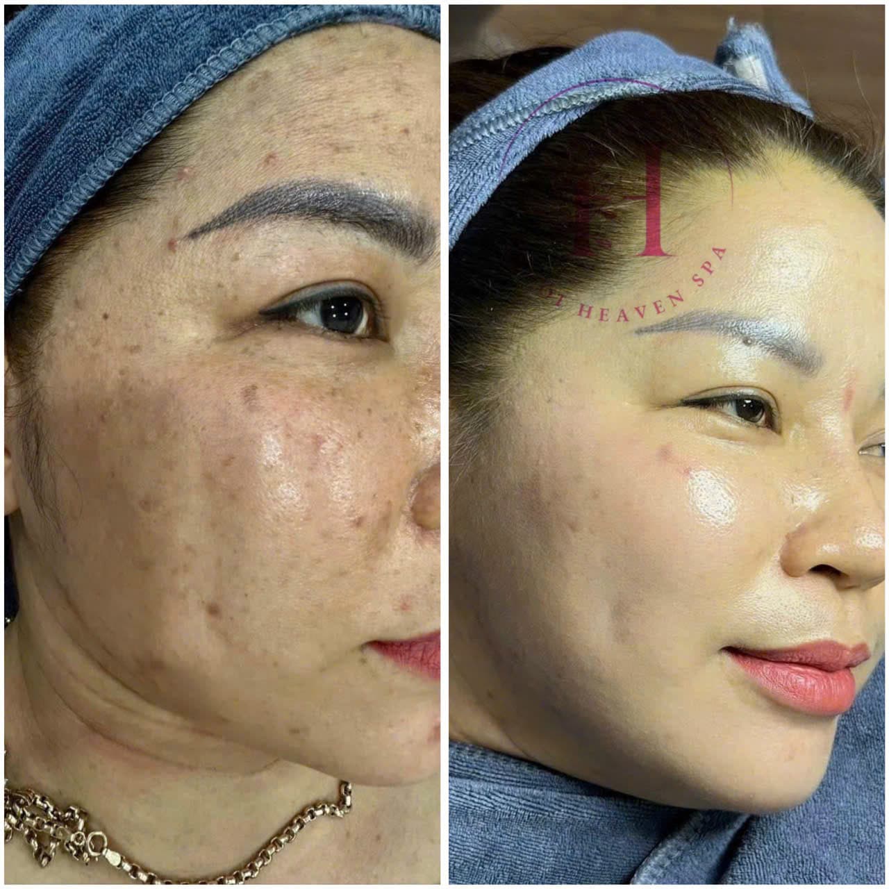 Hình ảnh kết quả 119