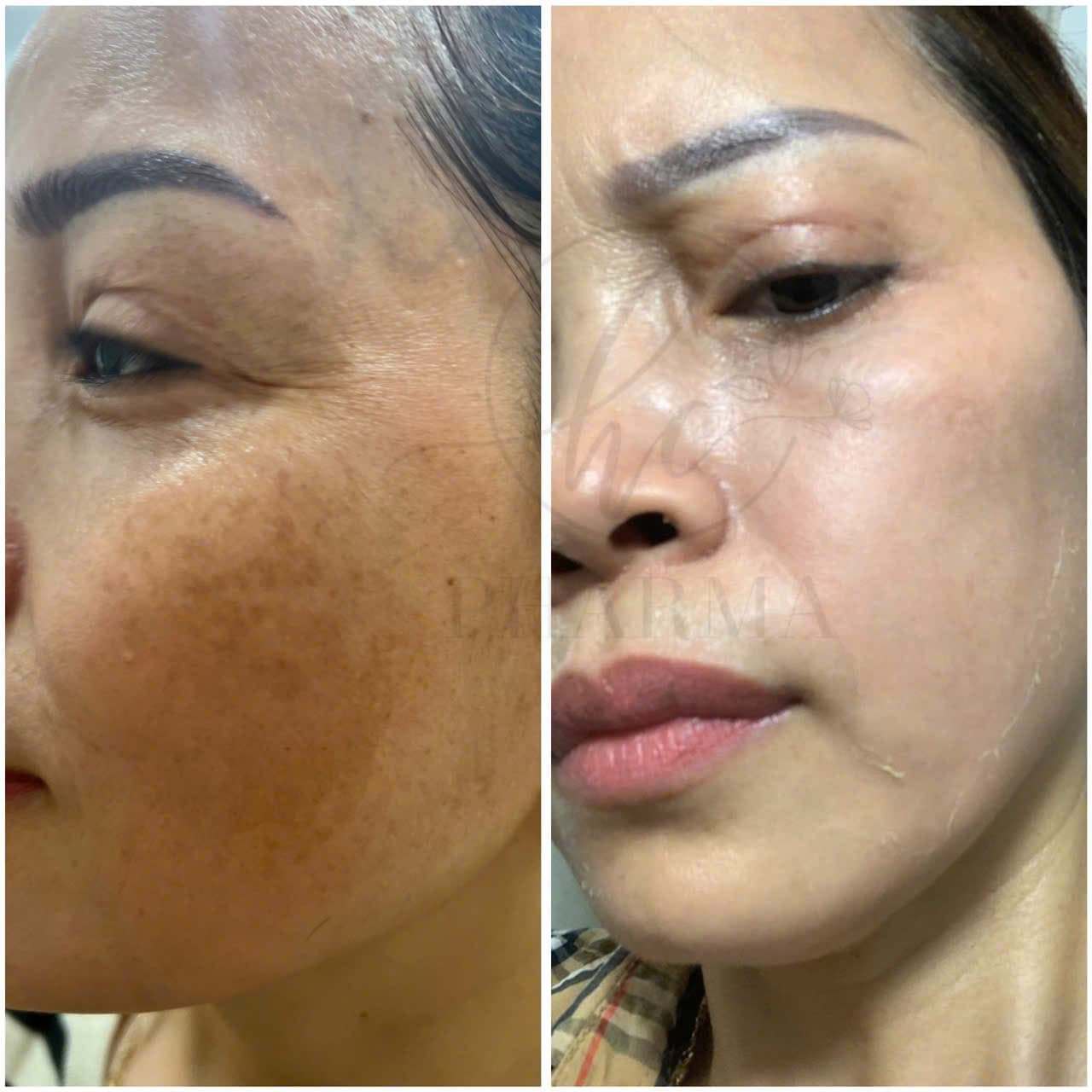 Hình ảnh kết quả 122