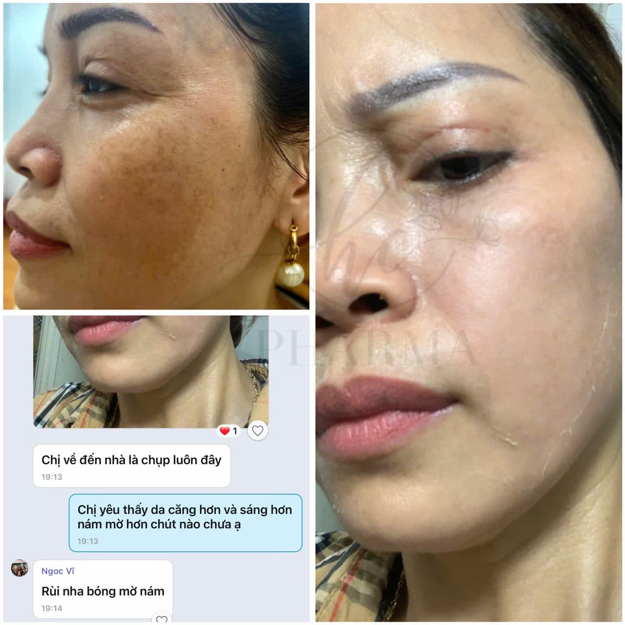Hình ảnh kết quả 124