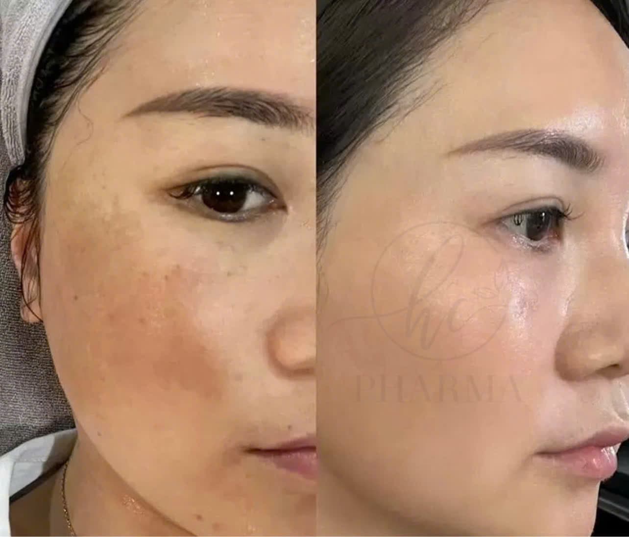 Hình ảnh kết quả 127