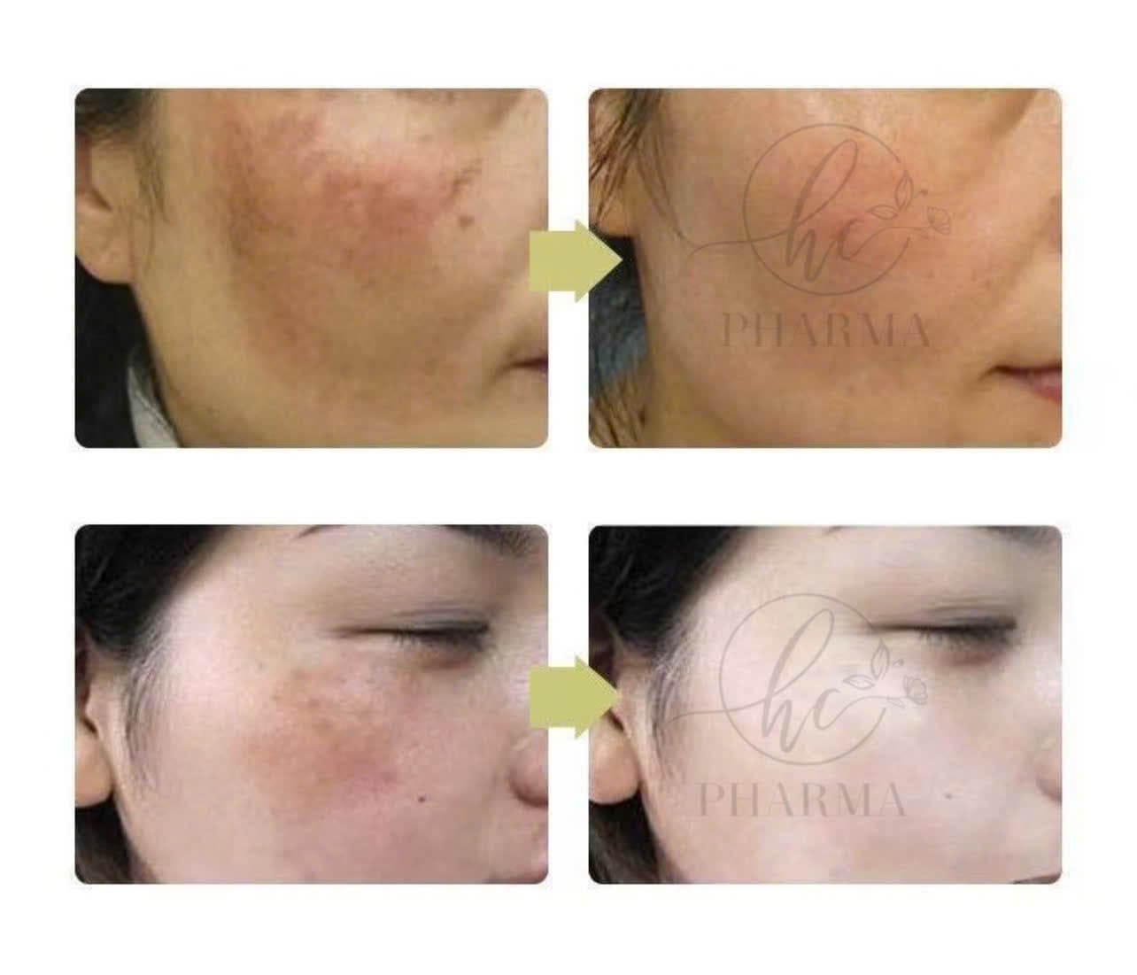 Hình ảnh kết quả 129