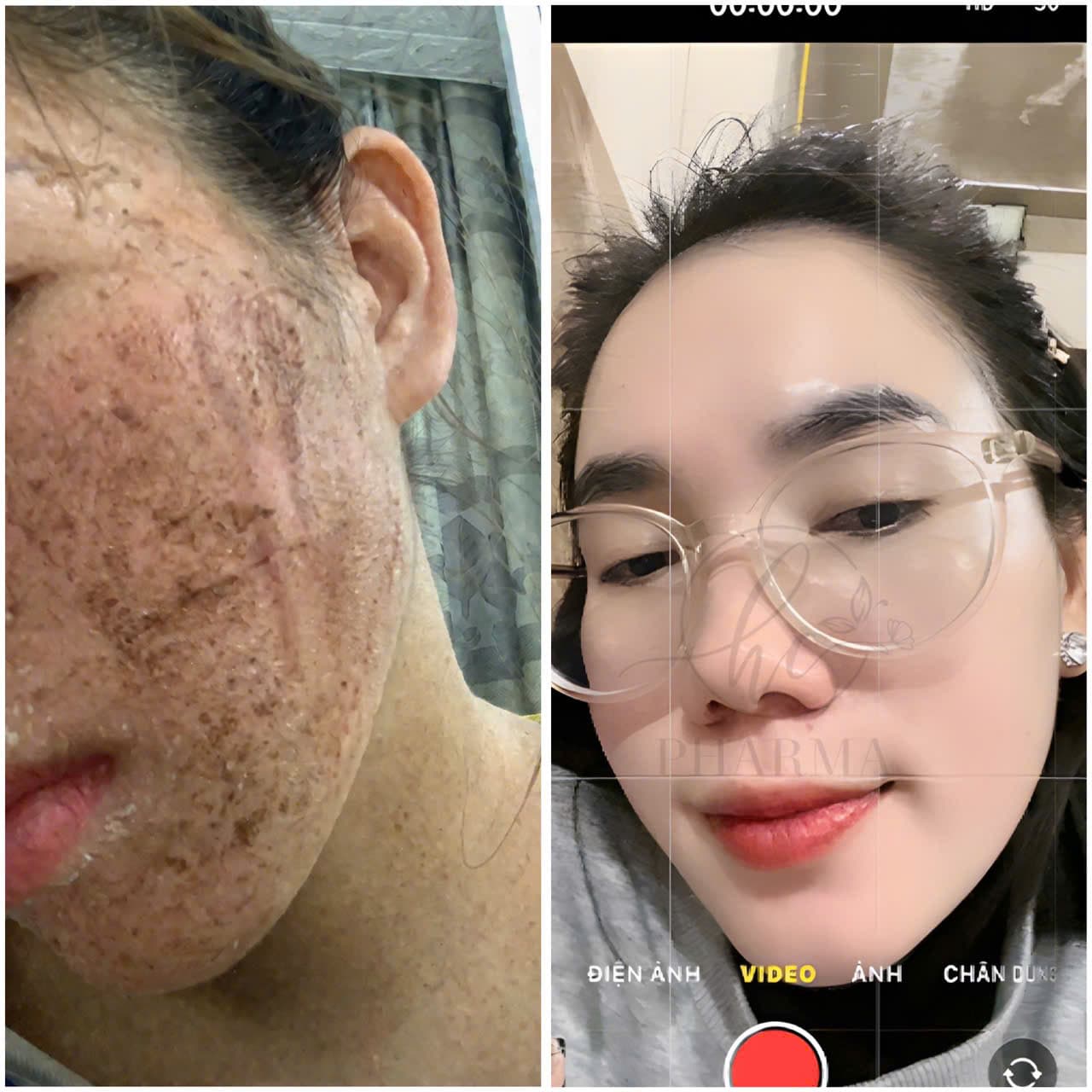 Hình ảnh kết quả 130