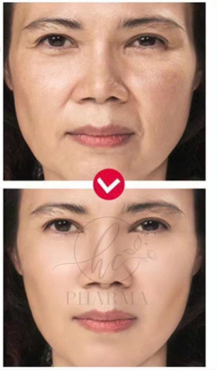 Hình ảnh kết quả 131