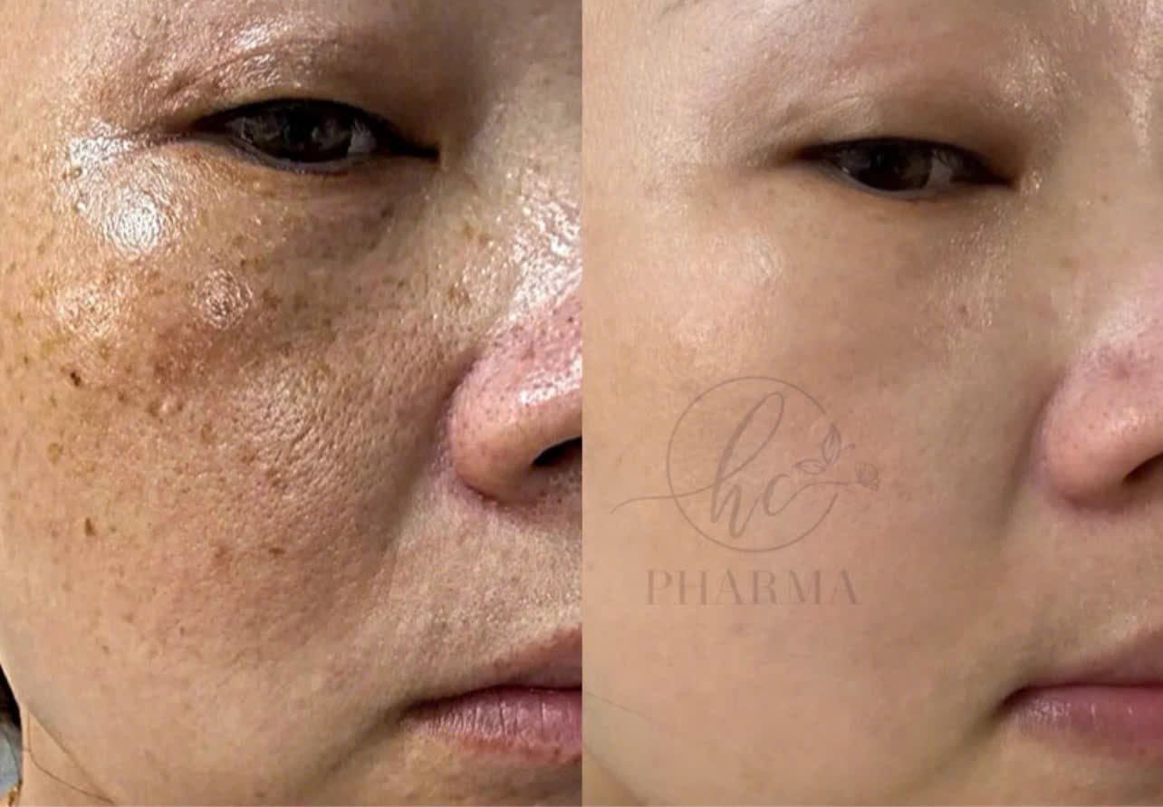 Hình ảnh kết quả 133