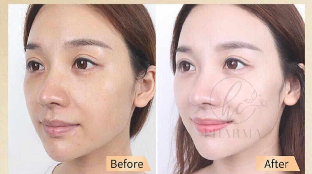 Hình ảnh kết quả 134