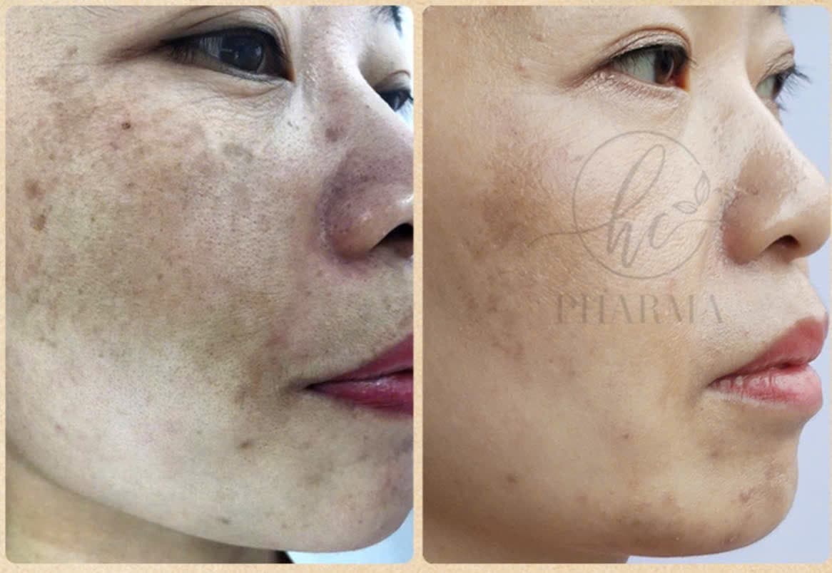 Hình ảnh kết quả 135