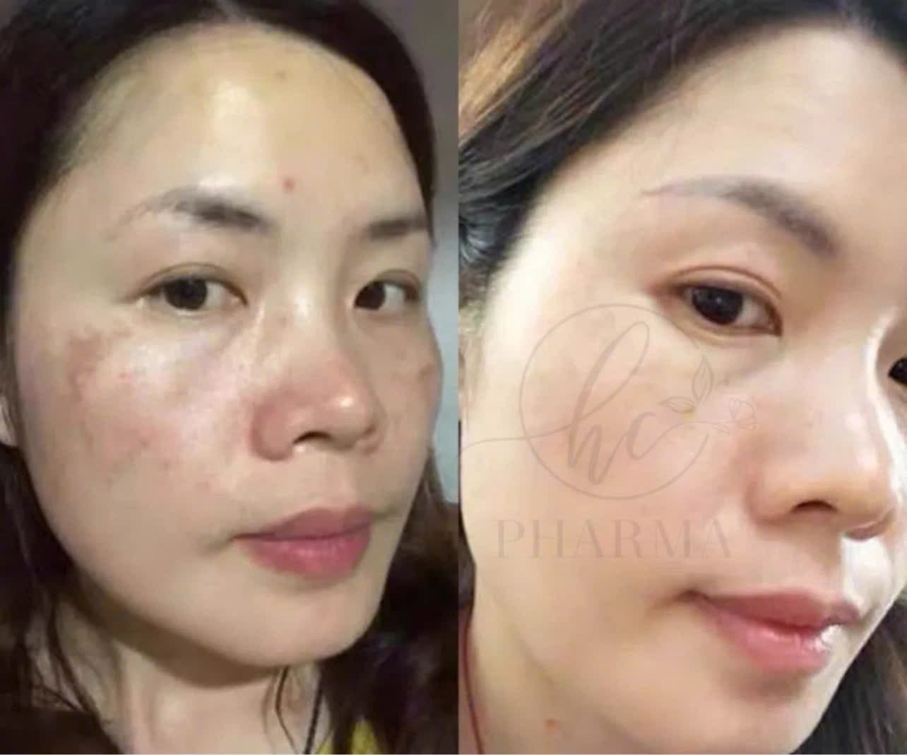 Hình ảnh kết quả 142