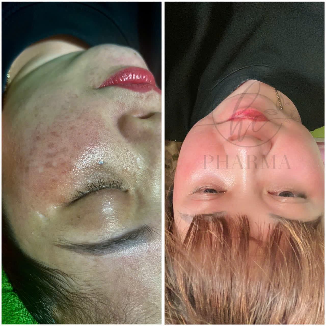 Hình ảnh kết quả 143